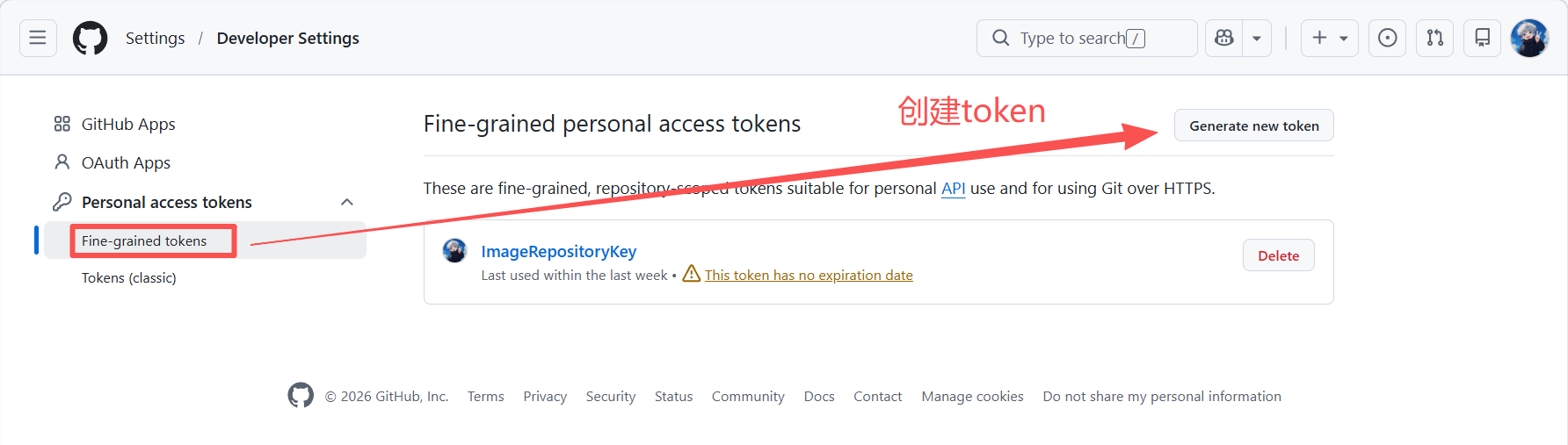 image-20260304014244909