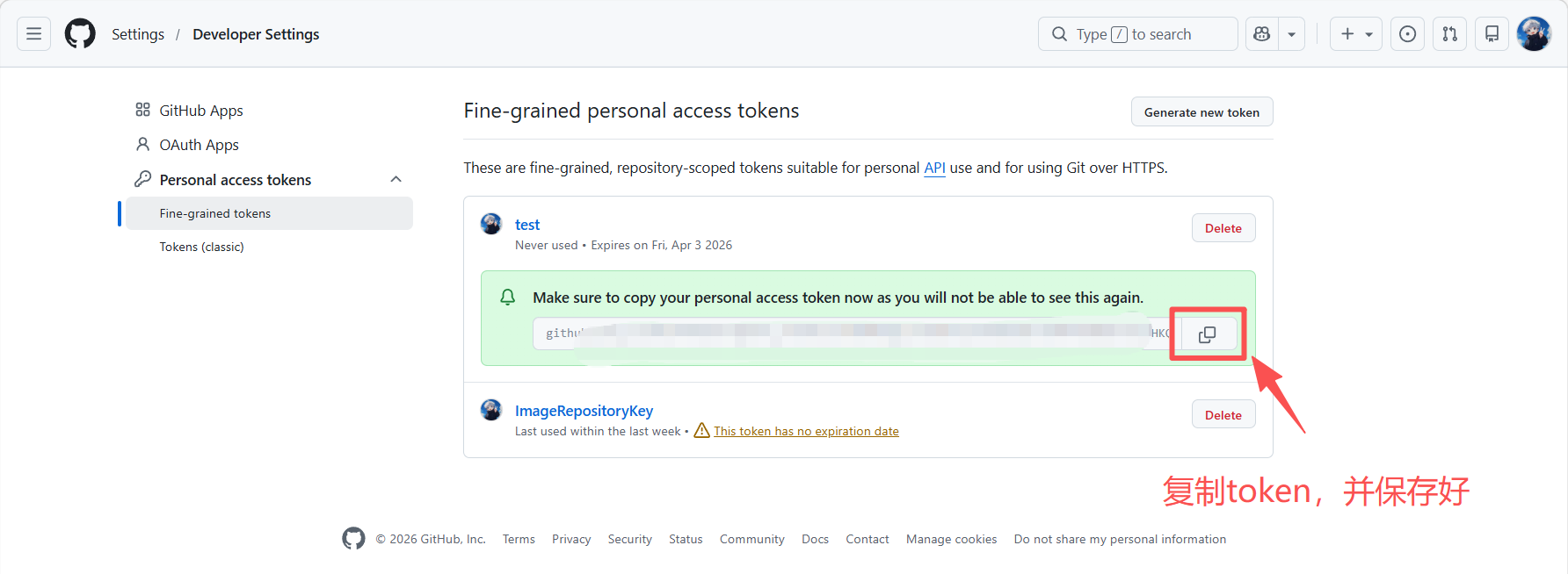 image-20260304020149336