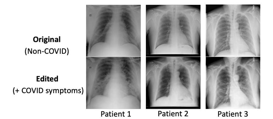 **Figure: Visual results of COVID-19 editing ** = 100x