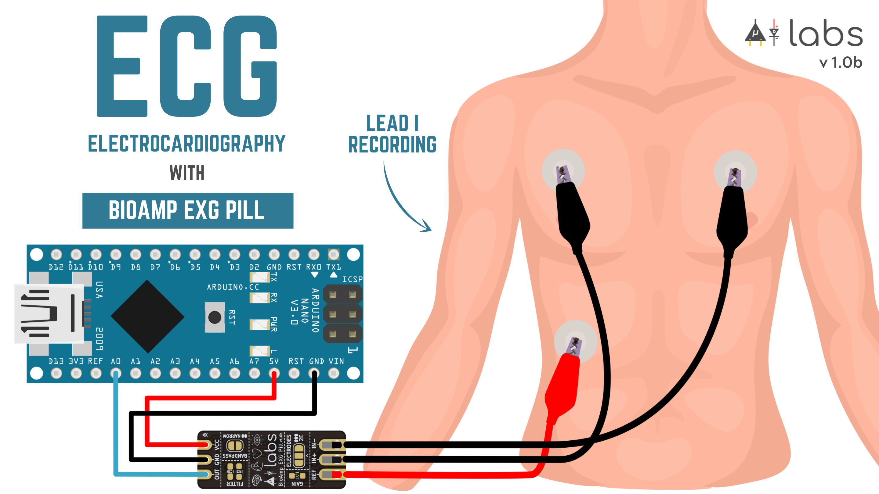 BioAmp EXG Pill - Electrocardiography (ECG) Lead 1