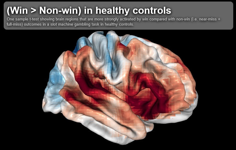 NeuroValut volume visualisation