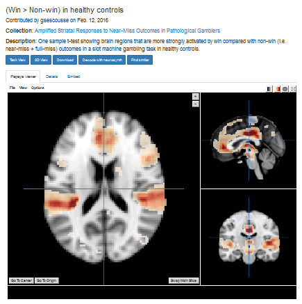 NeuroValut volume visualisation