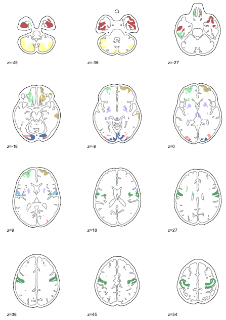 Multiple slices visualisation