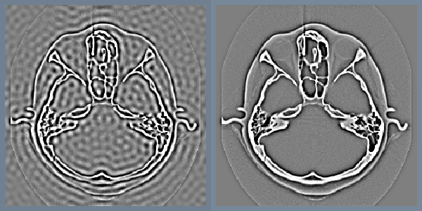 Figure 10-11