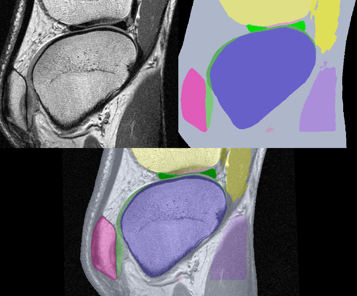 Figure 3-1