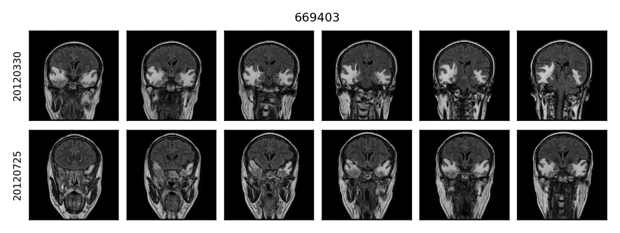 Supplement Figure 2