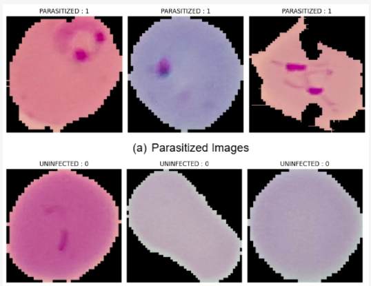 Malaria Cell Detection