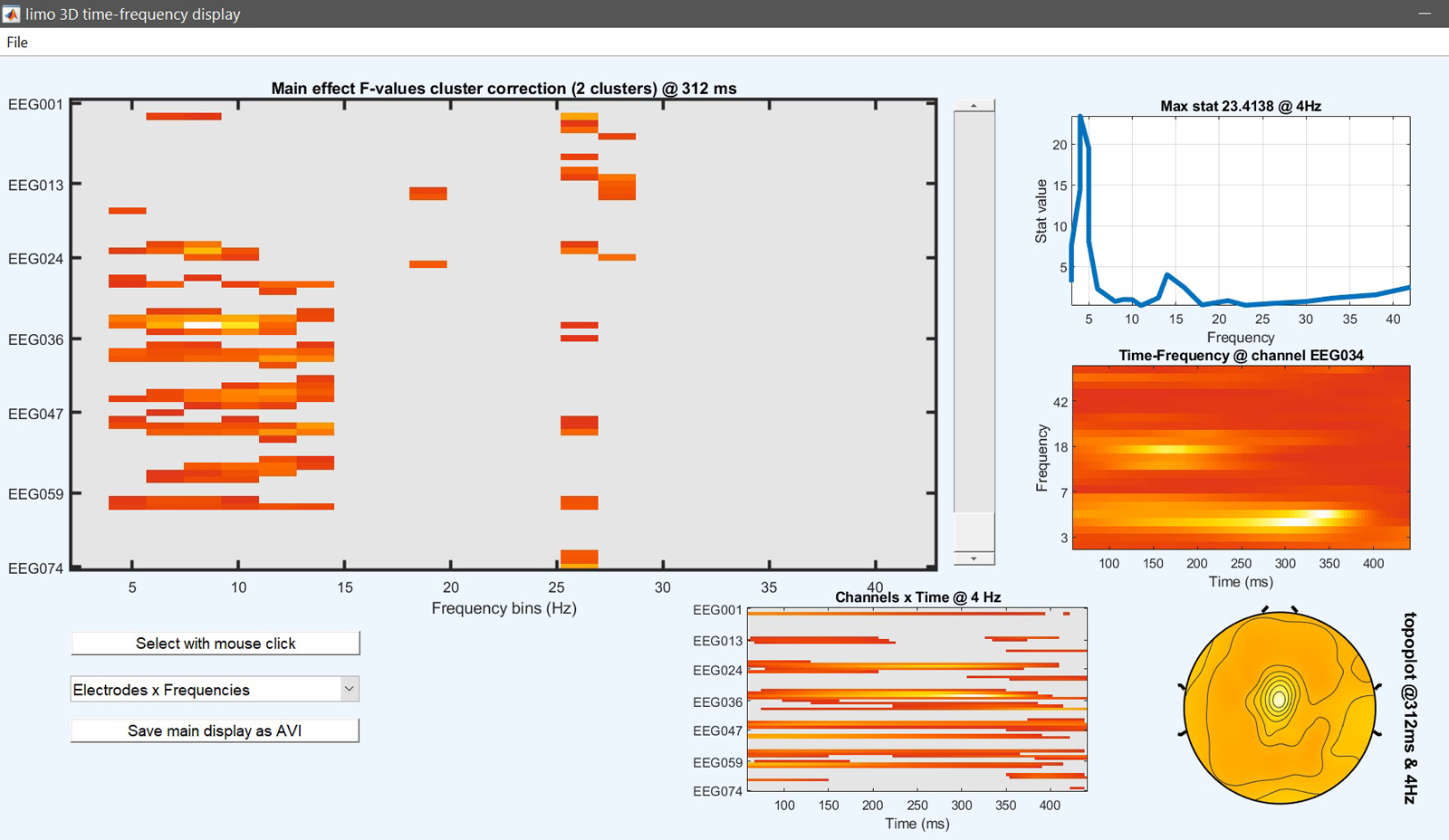 Figure 15. 1-way ANOVA ERSP Results for famous faces vs scrambled vs unfamiliar