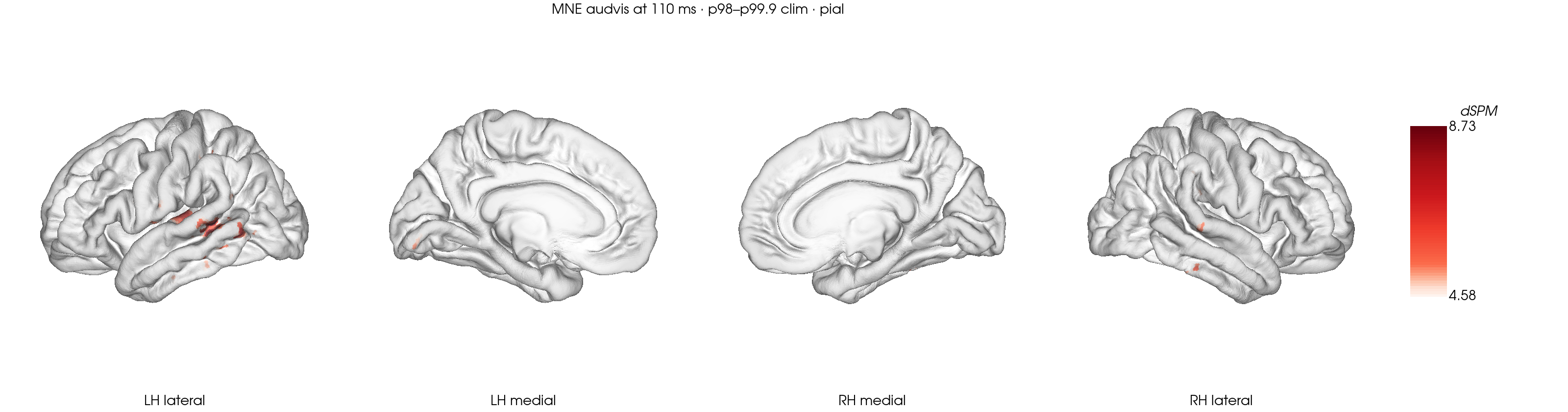 Optional BrainSpace pial-surface rendering
