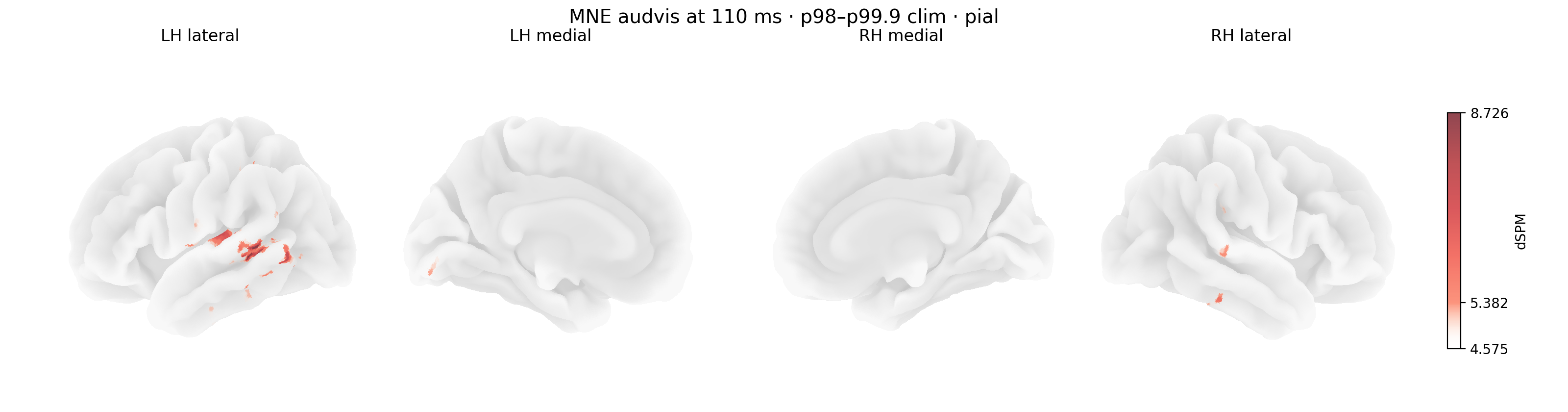 Optional Nilearn pial-surface rendering