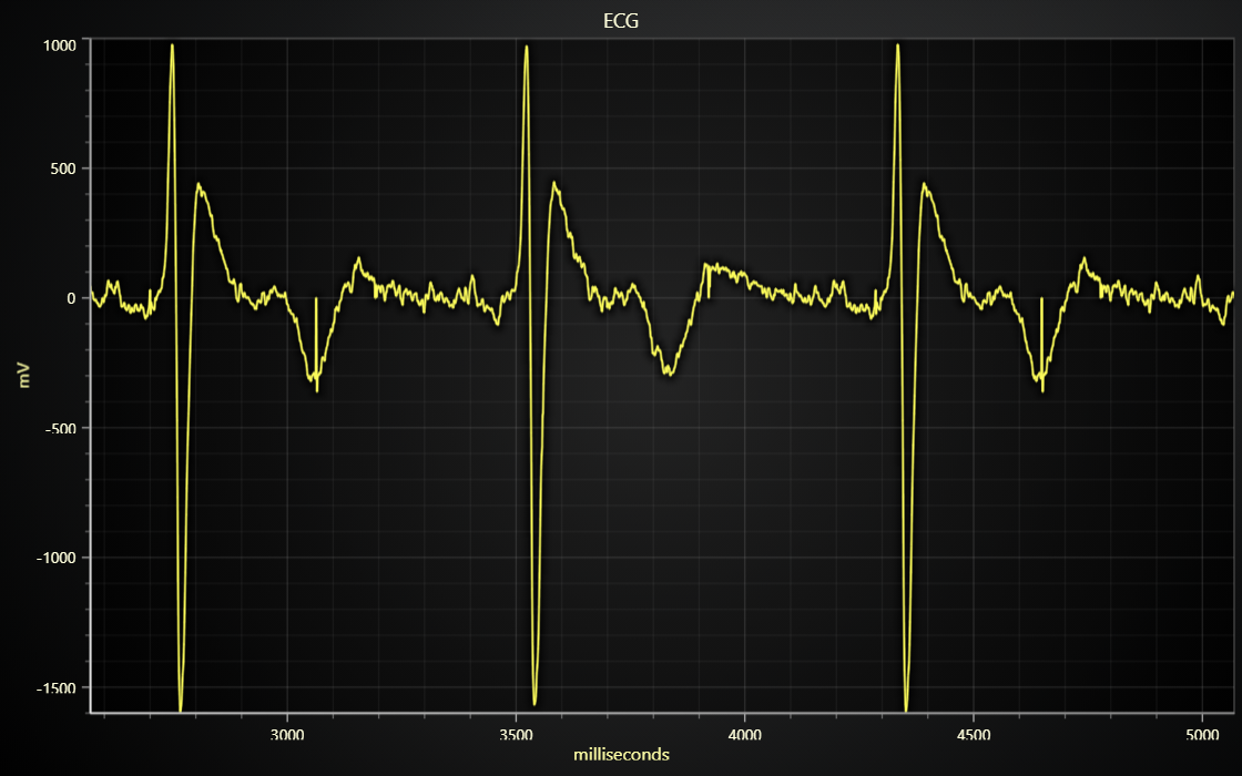 JavaScript ECG Chart