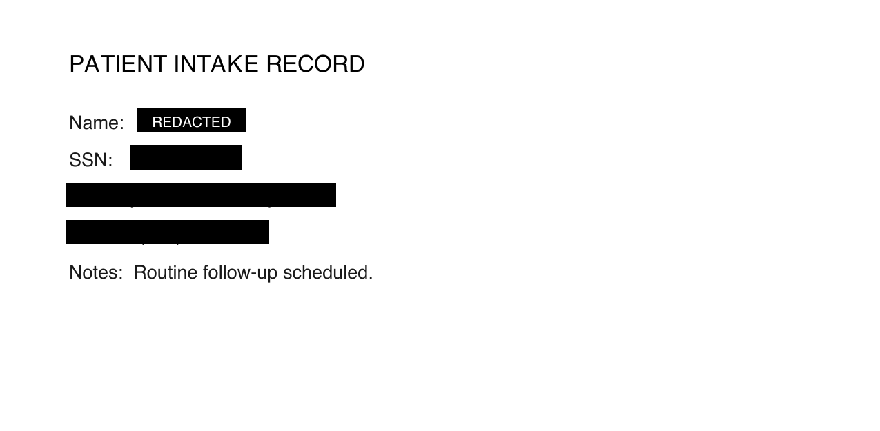 Same record with the SSN, email, phone, and name covered by solid bars, one labelled REDACTED
