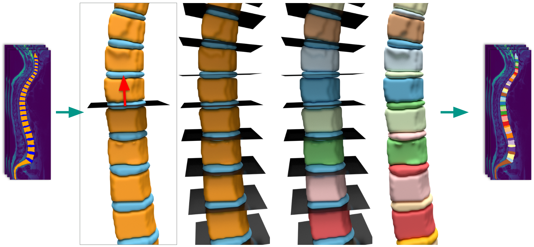 Instance splitting by IVD planes