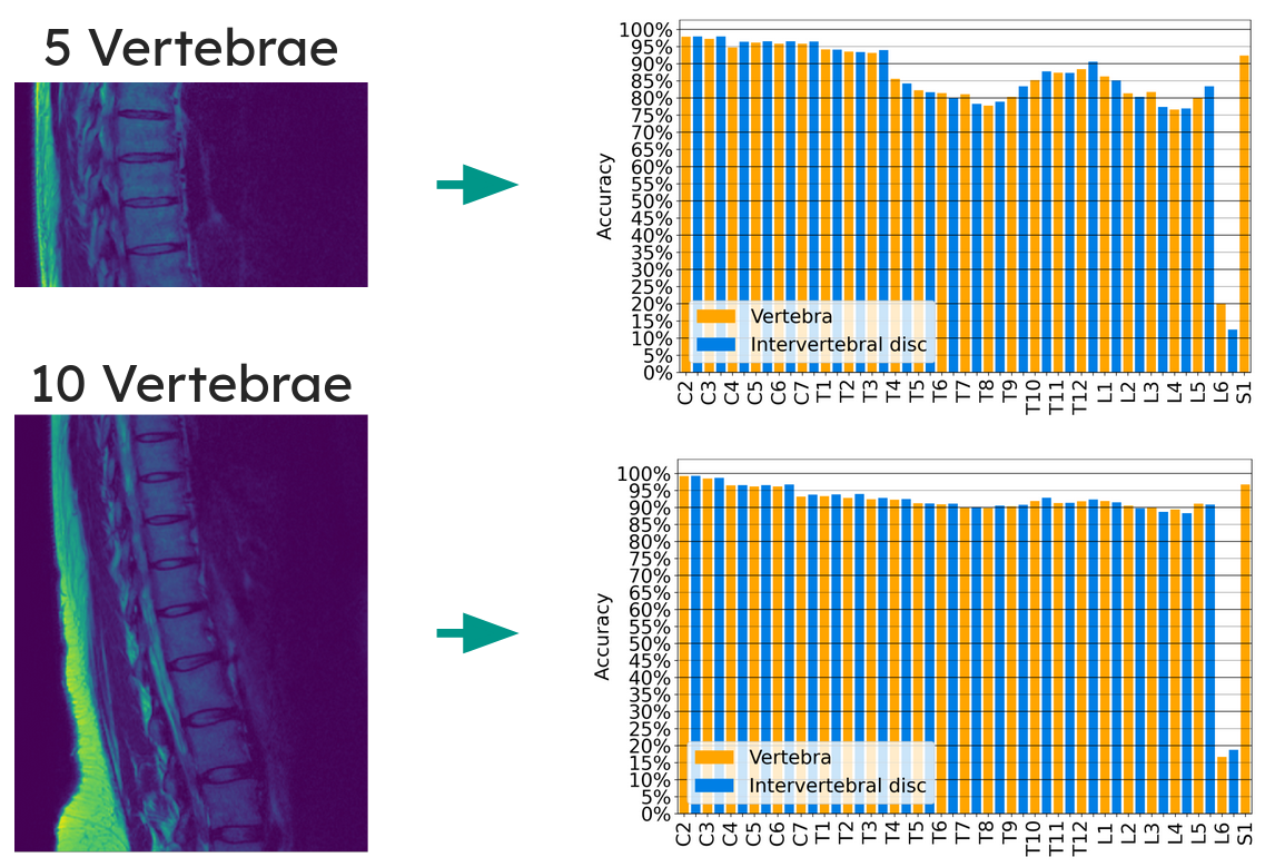 Per-vertebra accuracy for 5 and 10 visible vertebrae