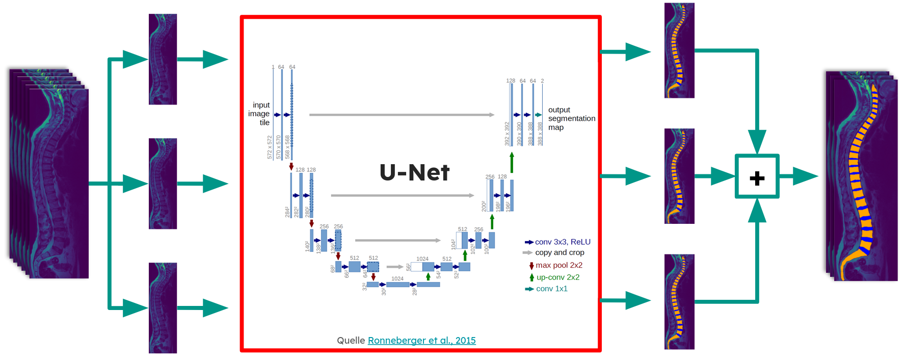 Slice-wise segmentation with U-Net