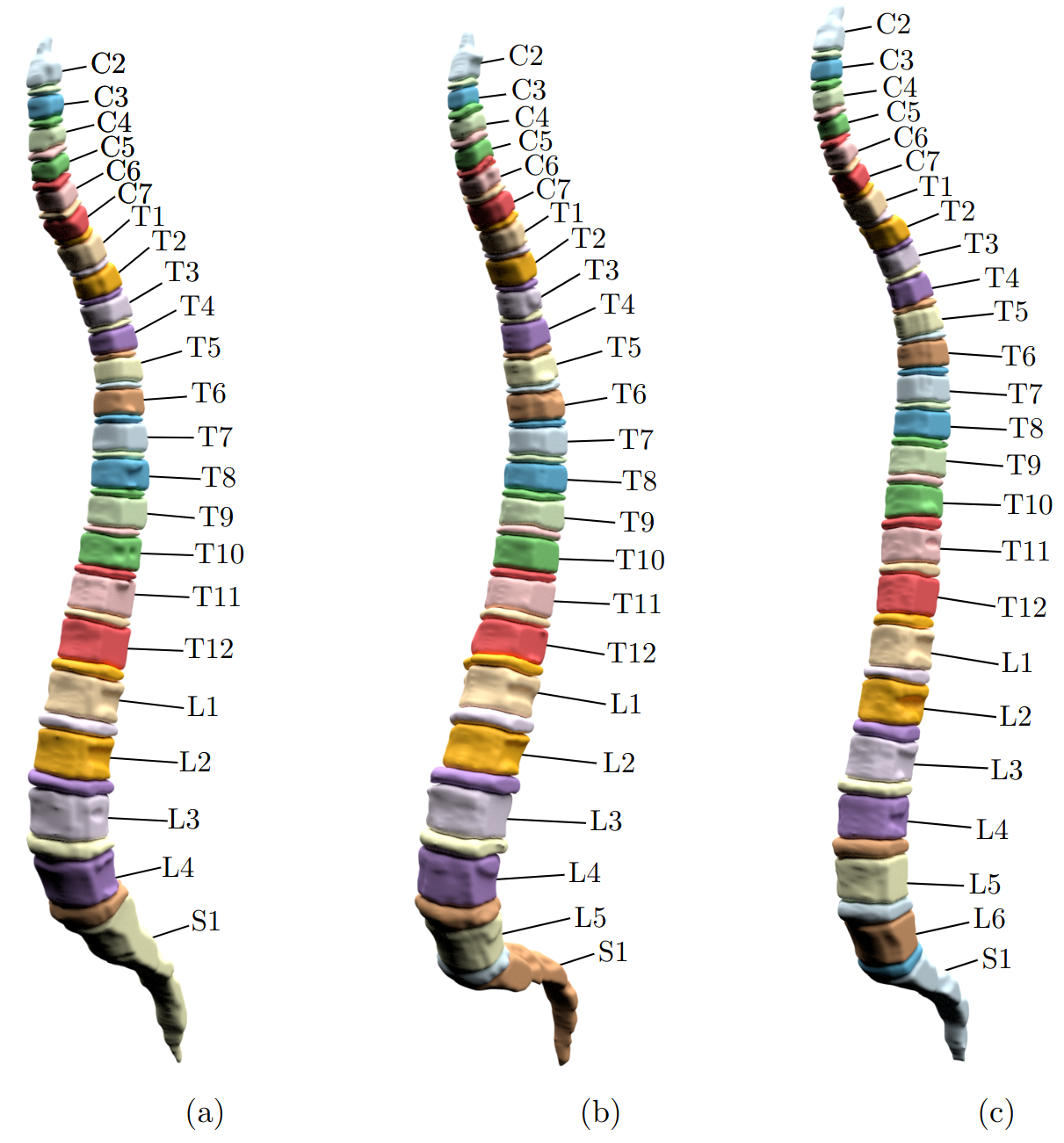 Three automatically segmented spines