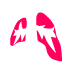 Pneumothorax Icon