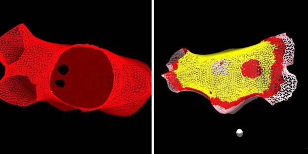 Real Left Atrium Mesh Model