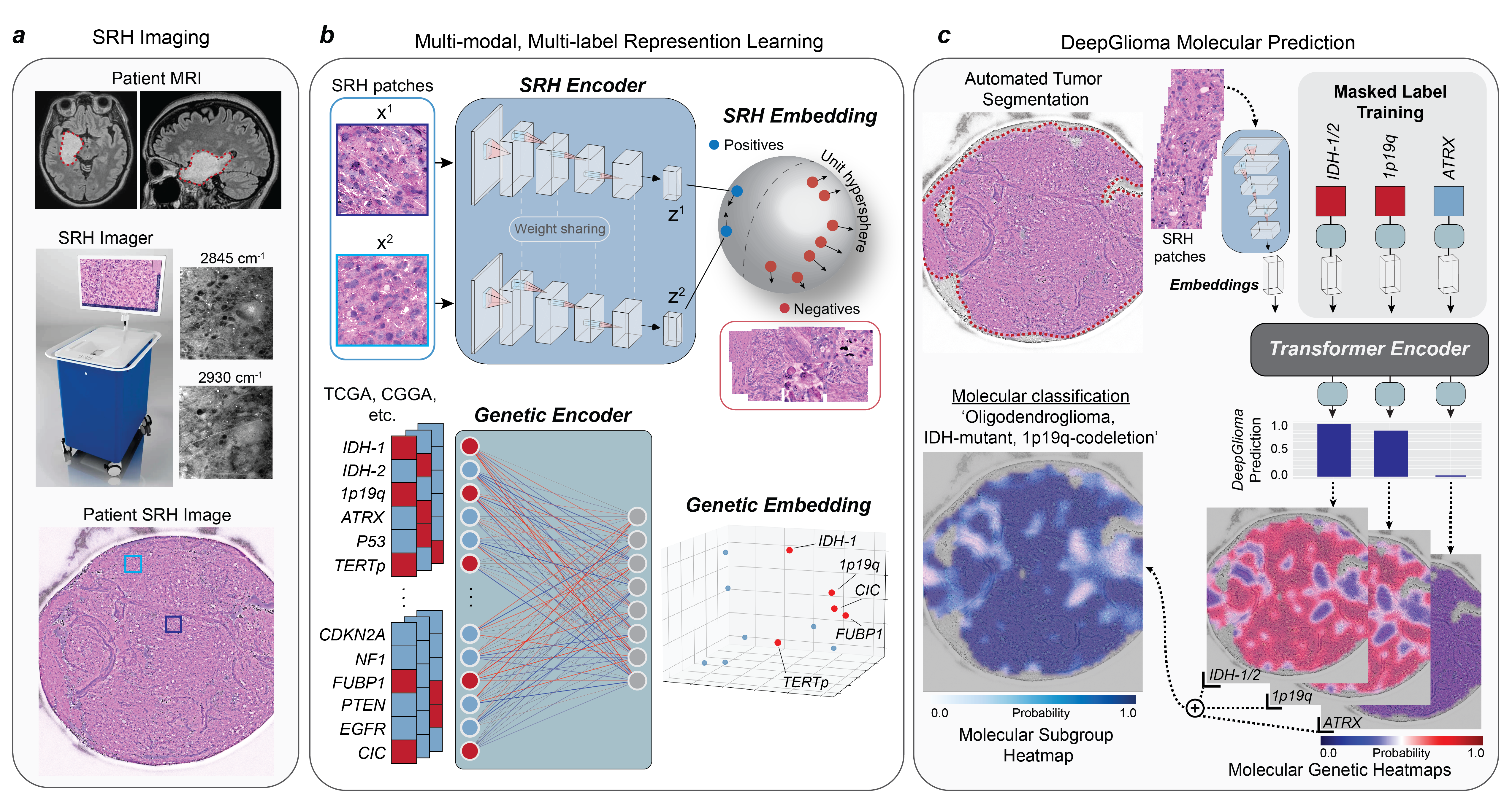Bedside SRH imaging and DeepGlioma model workflow
