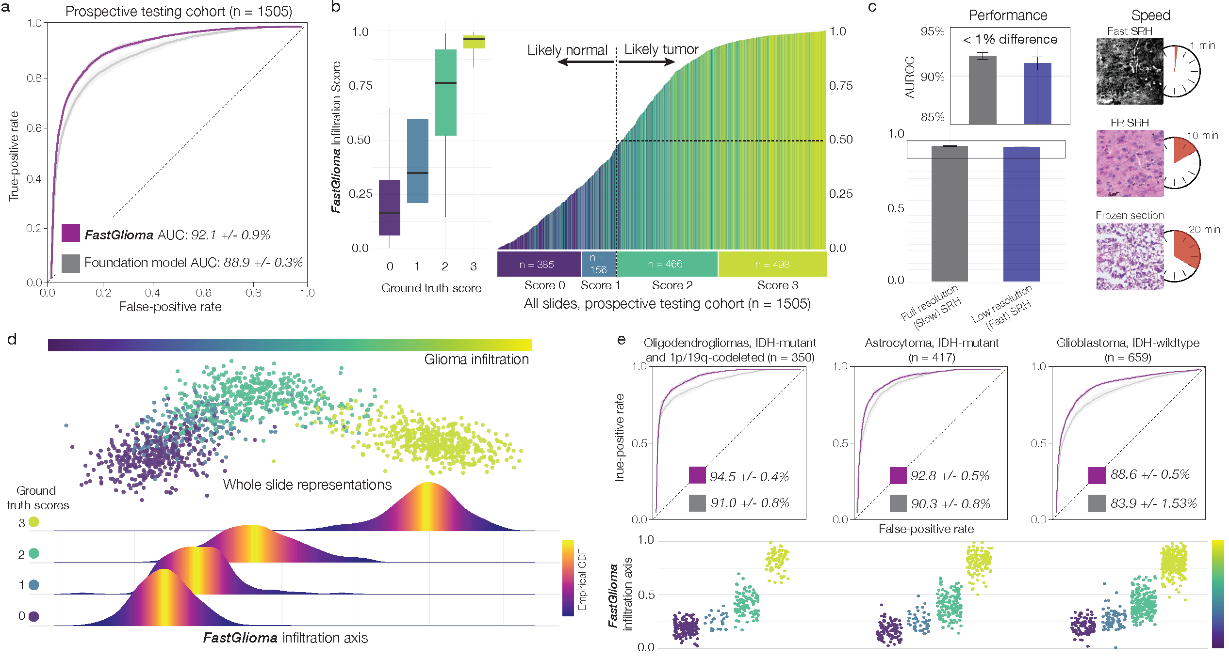 FastGlioma performance: ROC curves and results across glioma subtypes