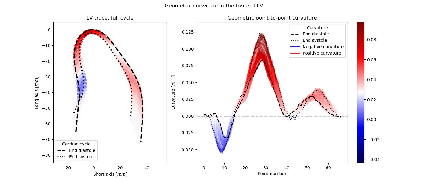 parabola