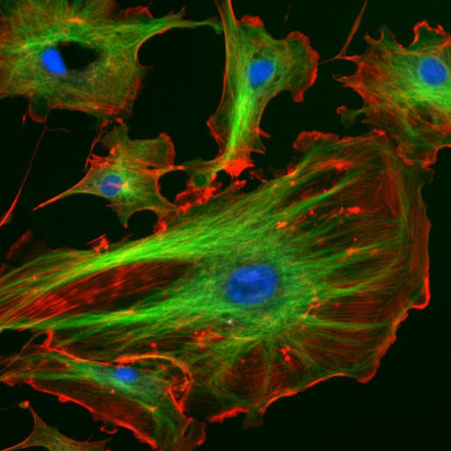 Stained cells in a cow blood vessel