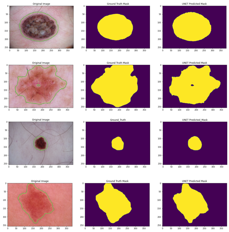 result_segmentation.png