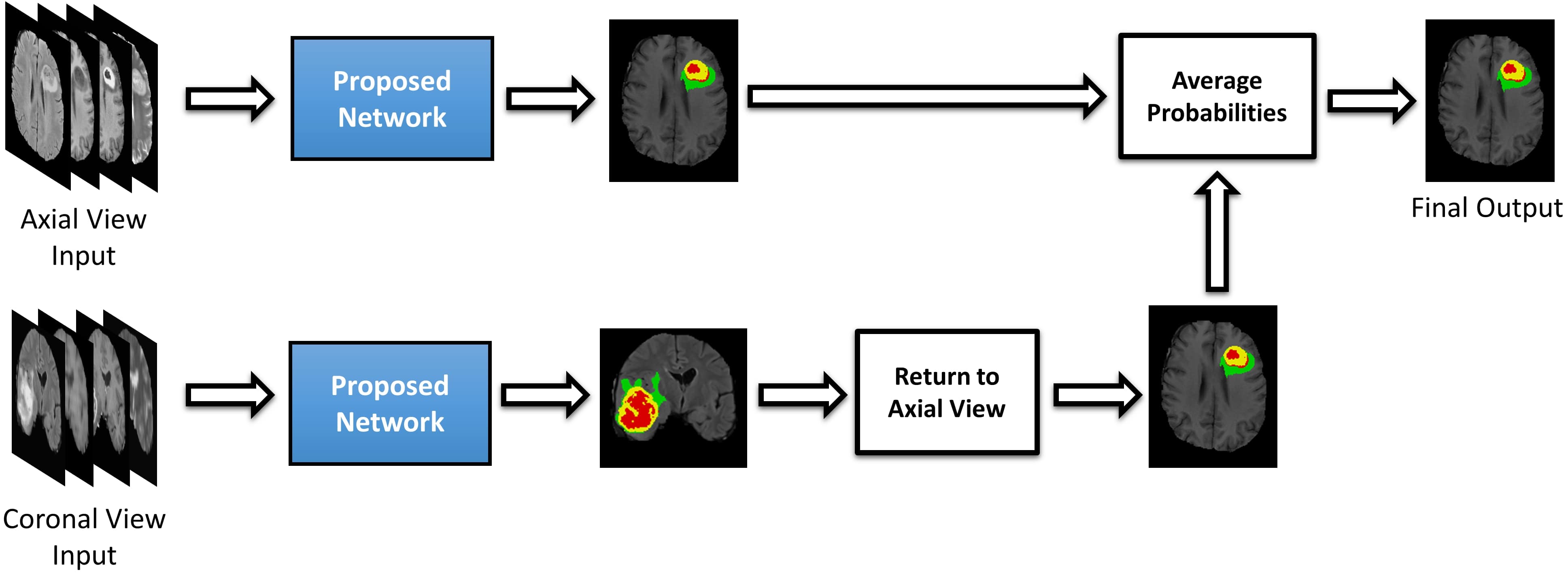 Brain Tumor Segmentation