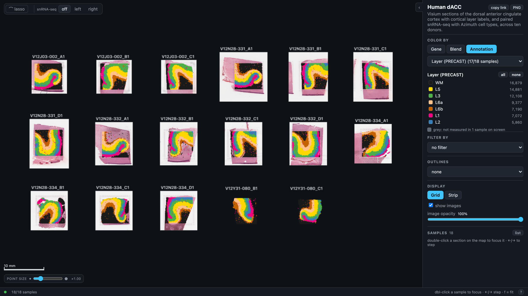 Seventeen Visium sections of human dACC on one canvas, H&E under cortical layer labels