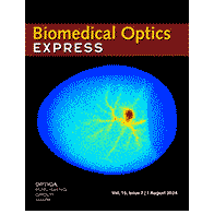 LSCI blood flow imaging