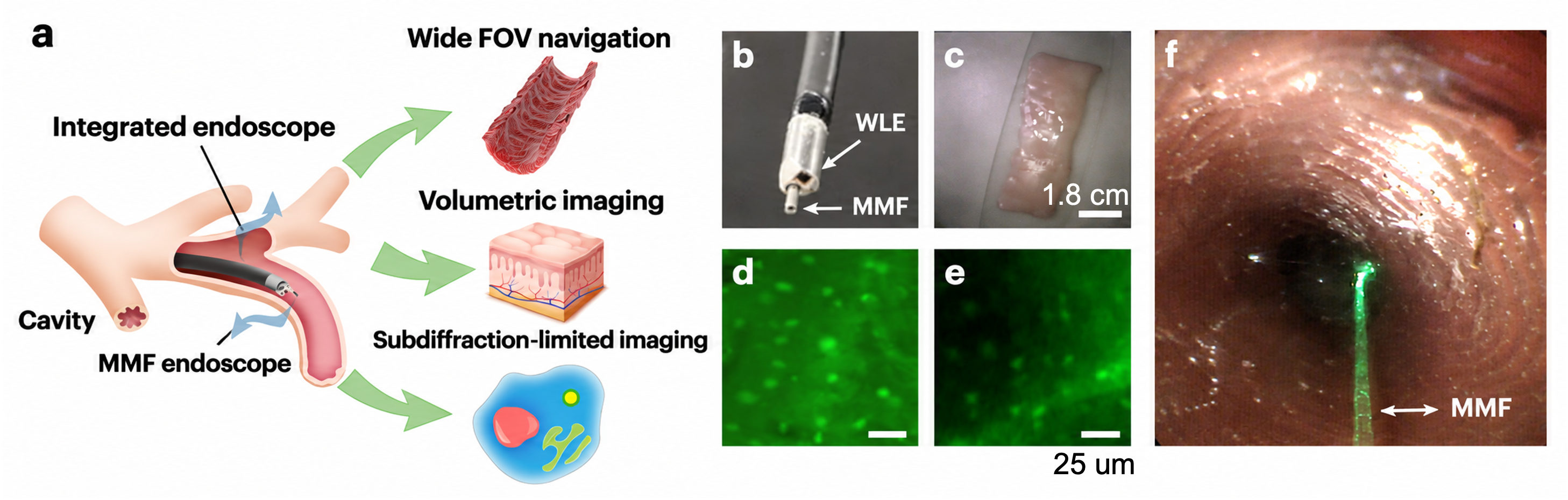 STABLE Integrated Endoscope