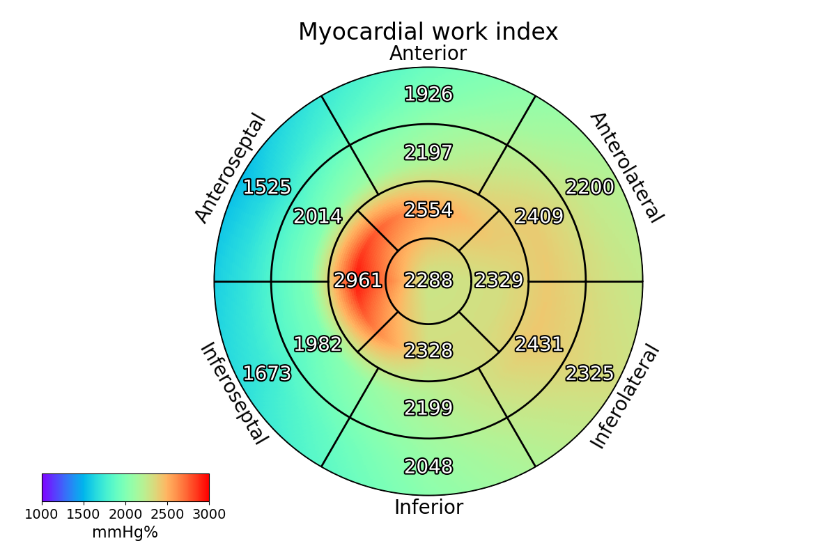 smooth plots