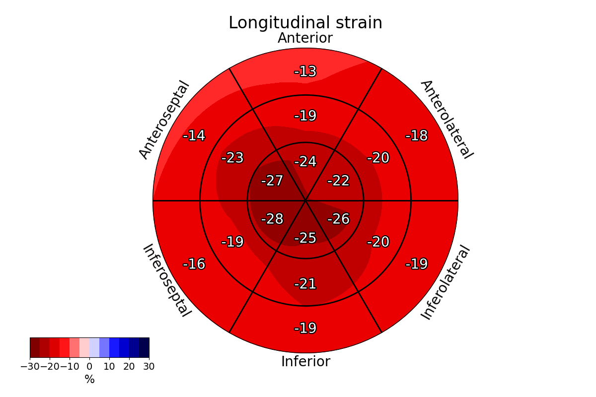 smooth plots