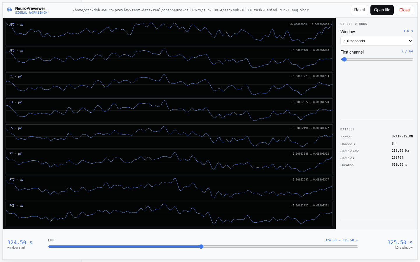 BrainVision signal workbench
