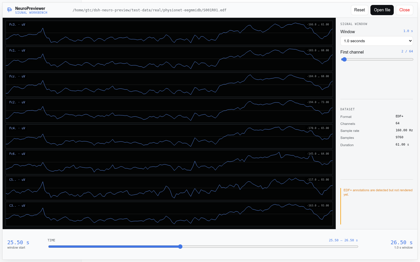 EDF signal workbench