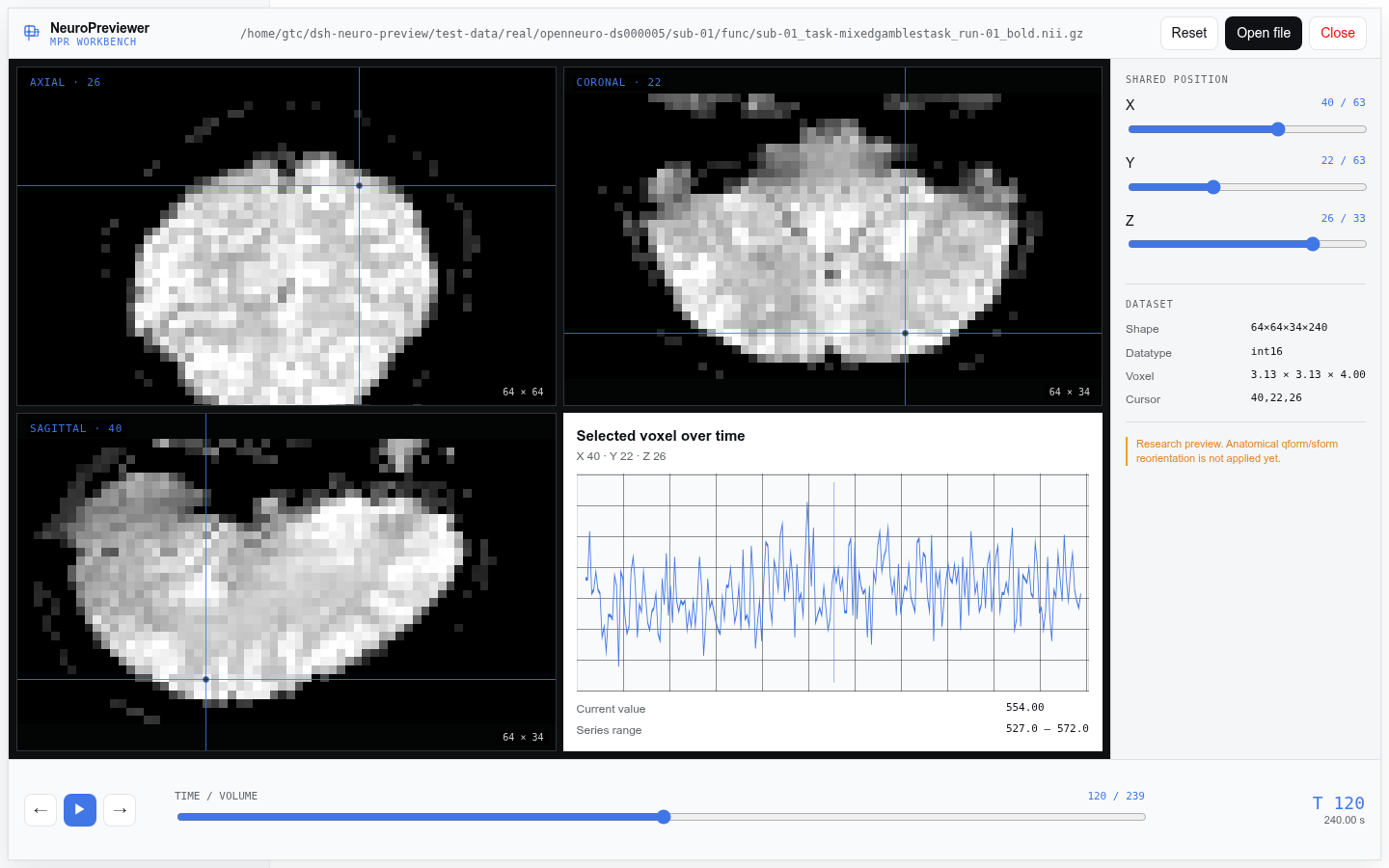 NeuroPreviewer interactive MPR workbench