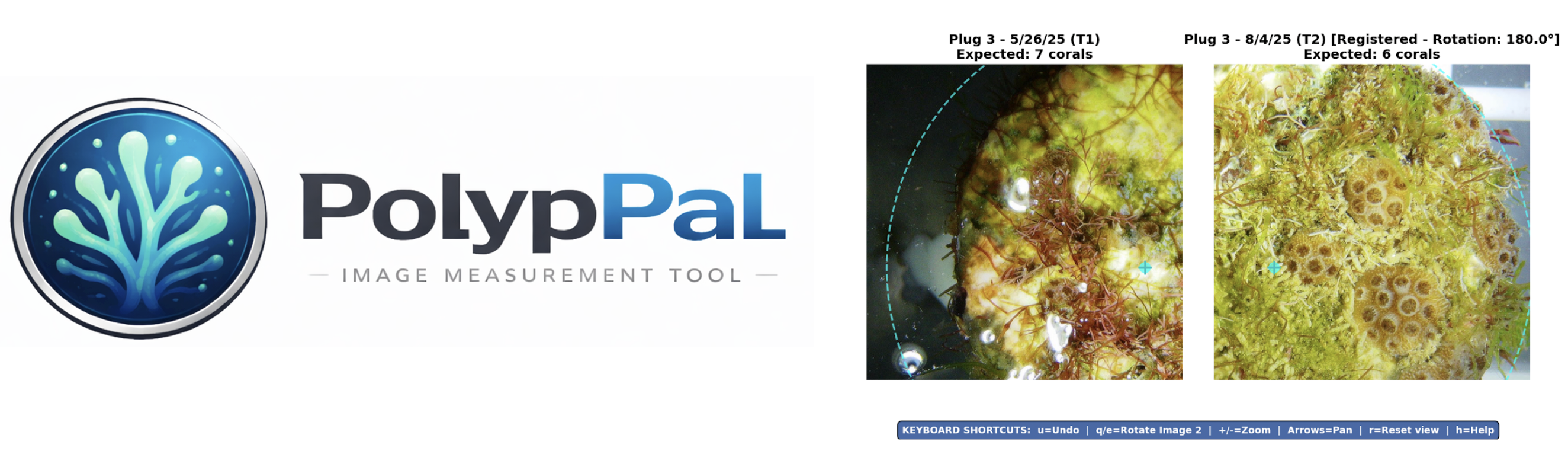 PolypPal interface