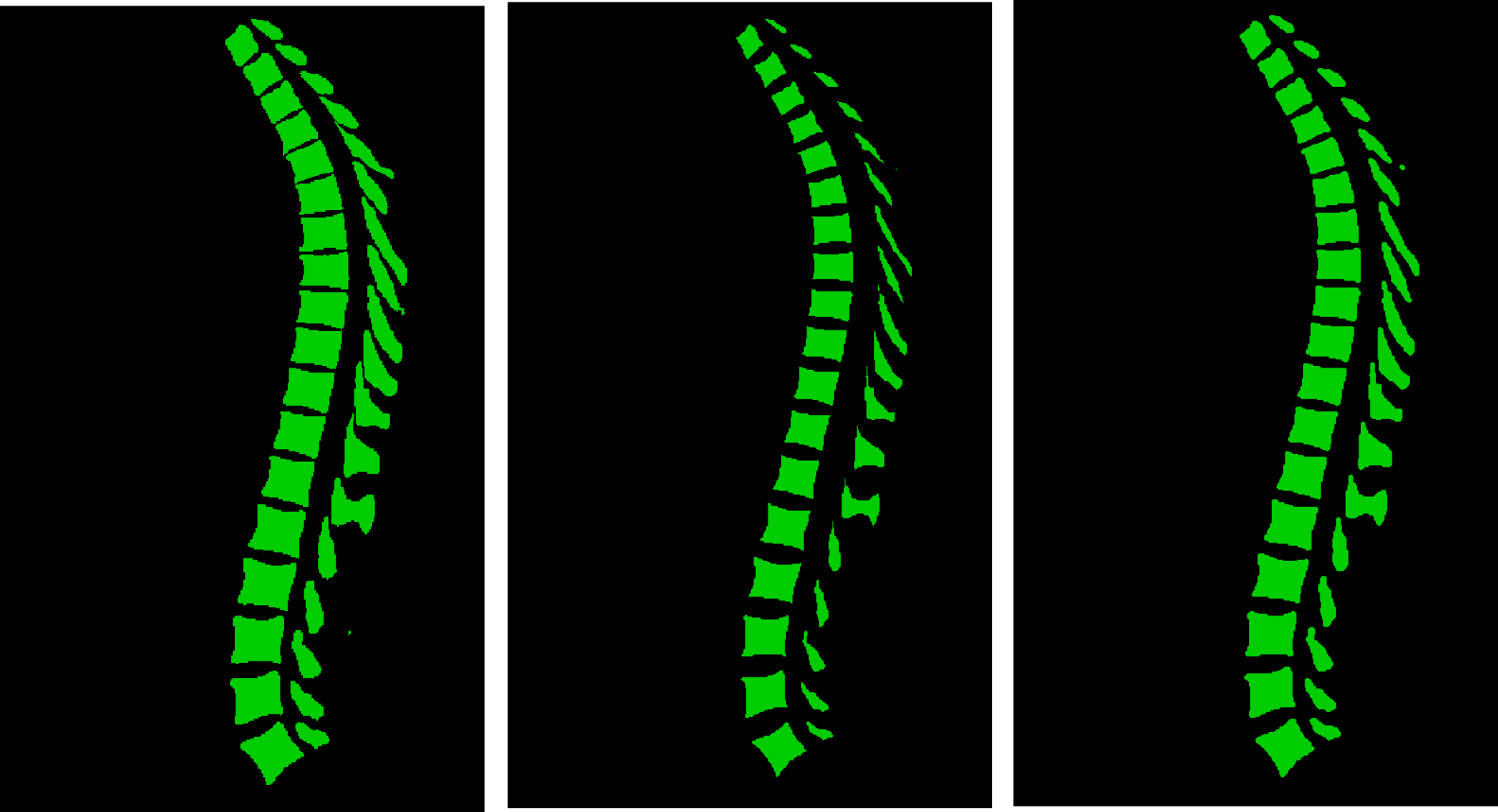 MultiClassSegmentationMorphology