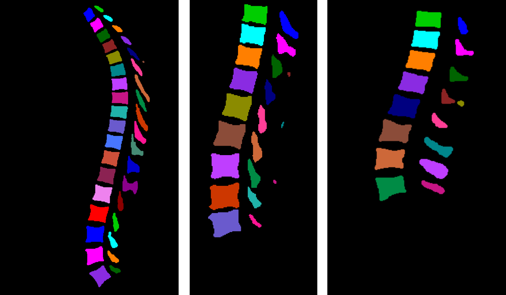 MultiClassSegmentationConnectedComponents