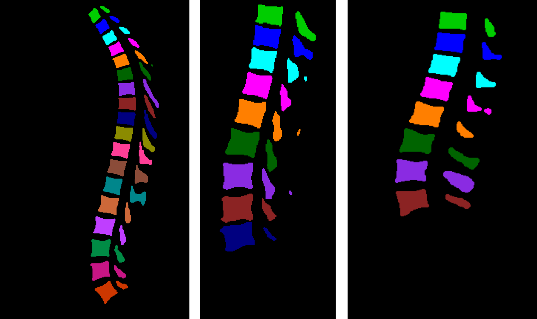 MultiClassSegmentationClustering