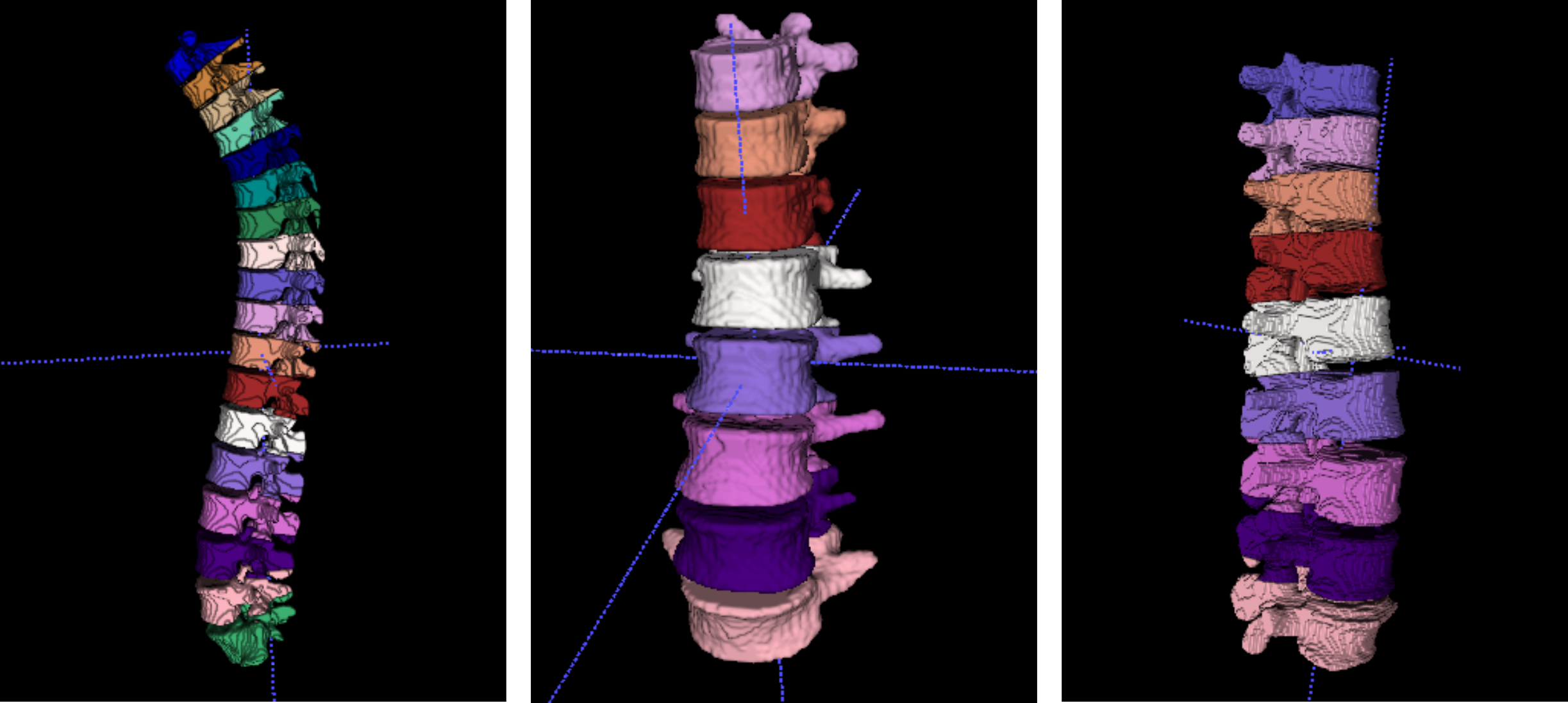 MultiClassSegmentationMesh