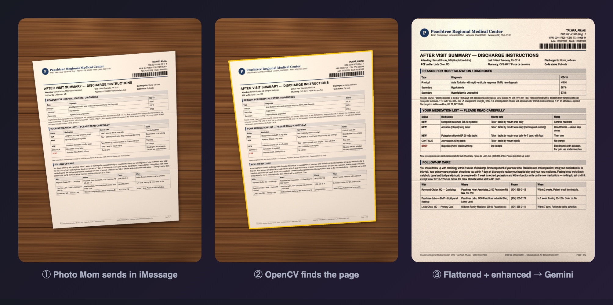 A phone photo of a discharge summary, the page OpenCV detected, and the flattened scan sent to Gemini