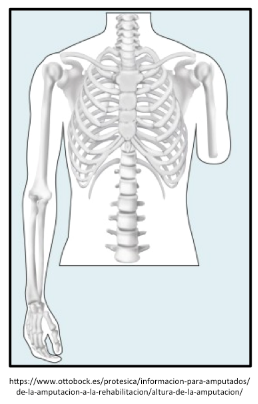 Limb rotation limitations