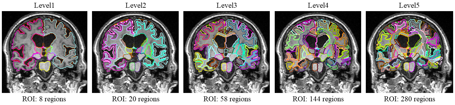 supplementary_level