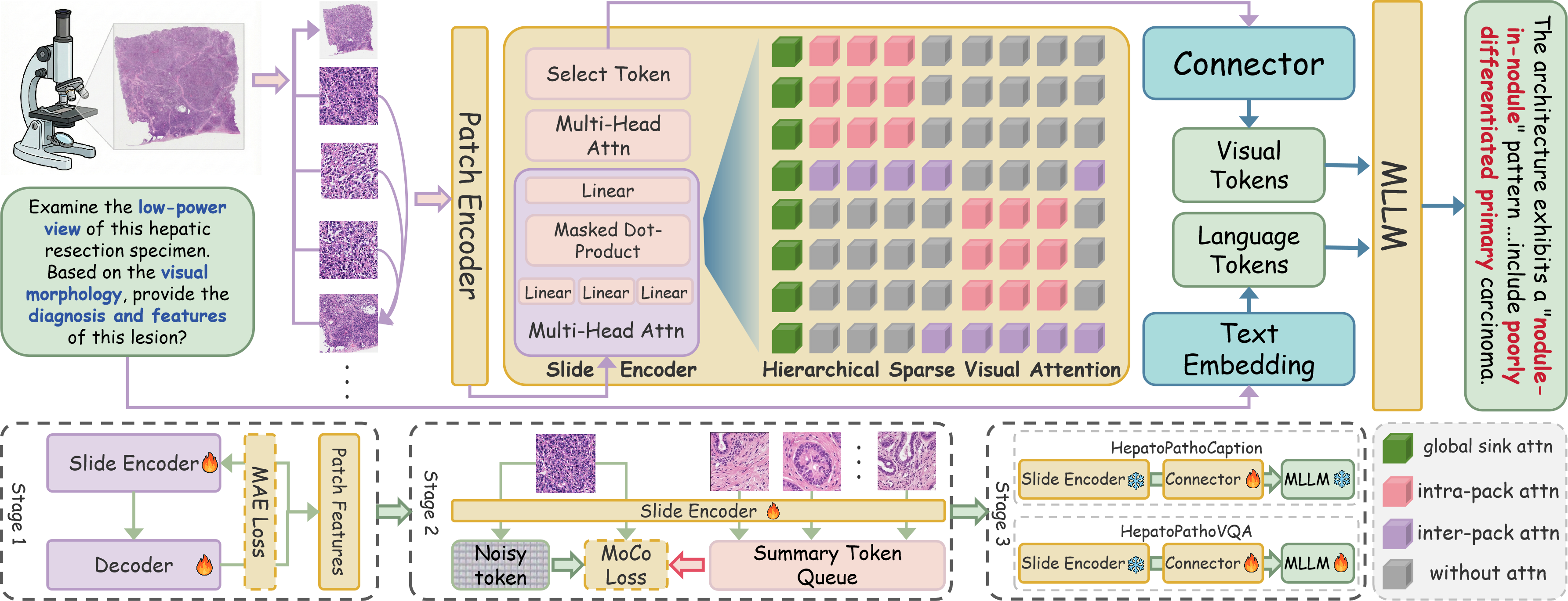 Hepato-LLaVA Framework