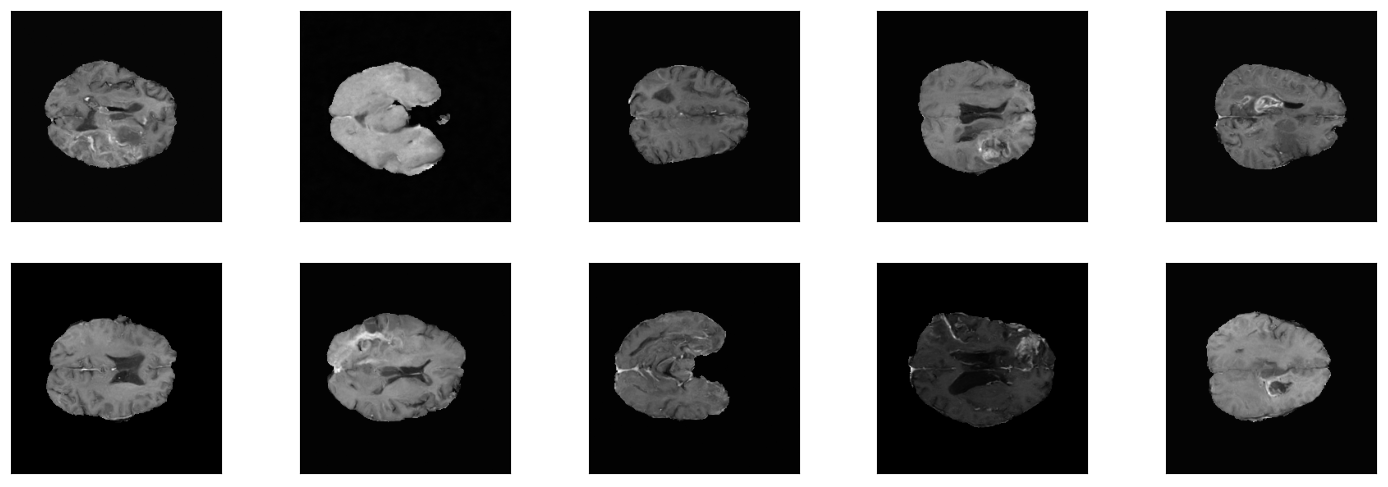 Example images from One-Channel-Model