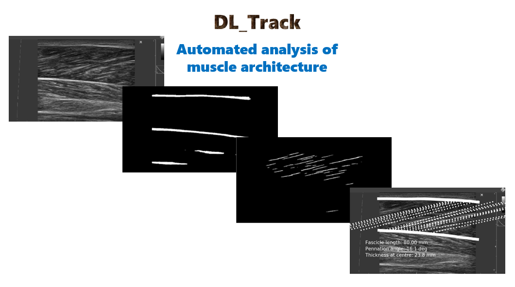 DL_Track image