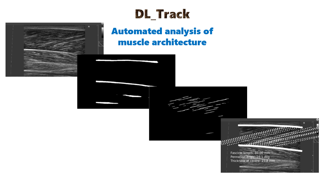 DL_Track_US image
