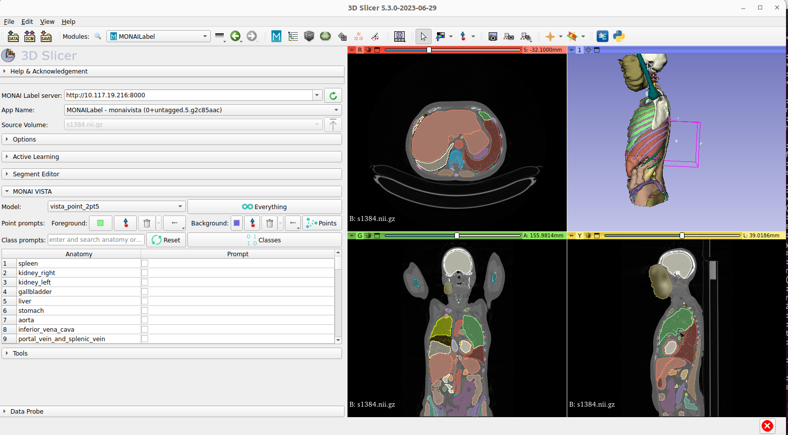 VISTA-3D whole-body CT segmentation