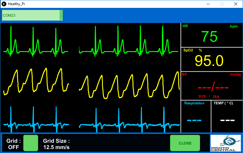 GUI in Processing